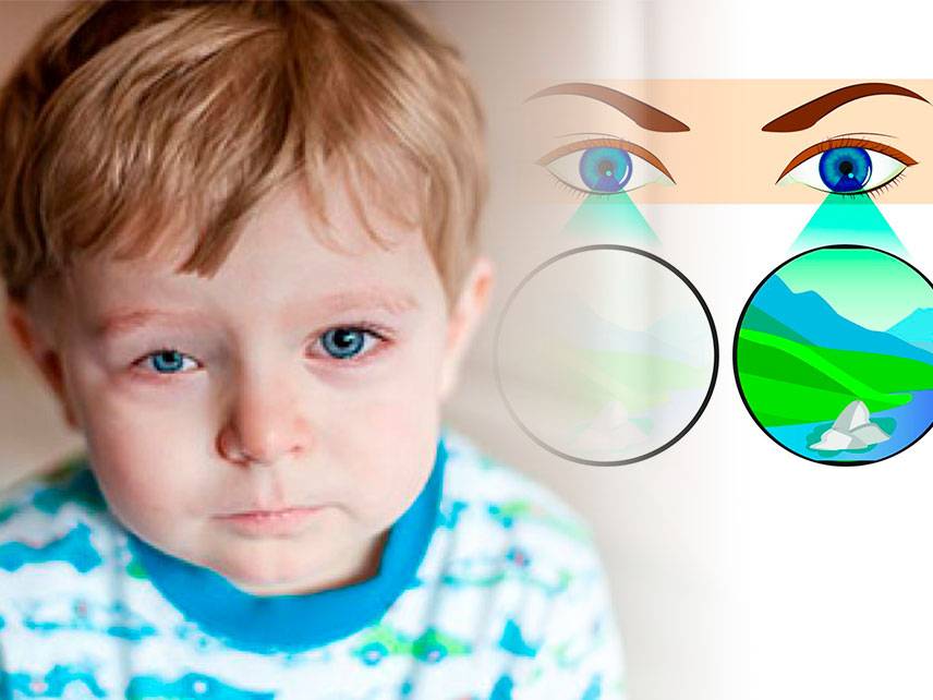 What is amblyopia and how is it treated?