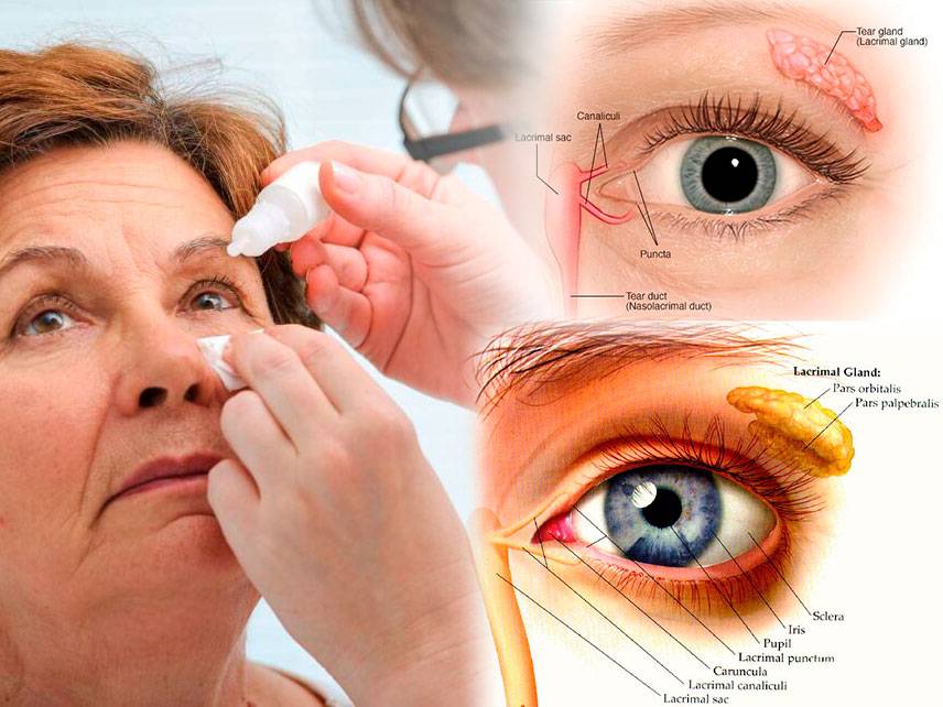 ¿Puede curarse el síndrome del ojo seco?